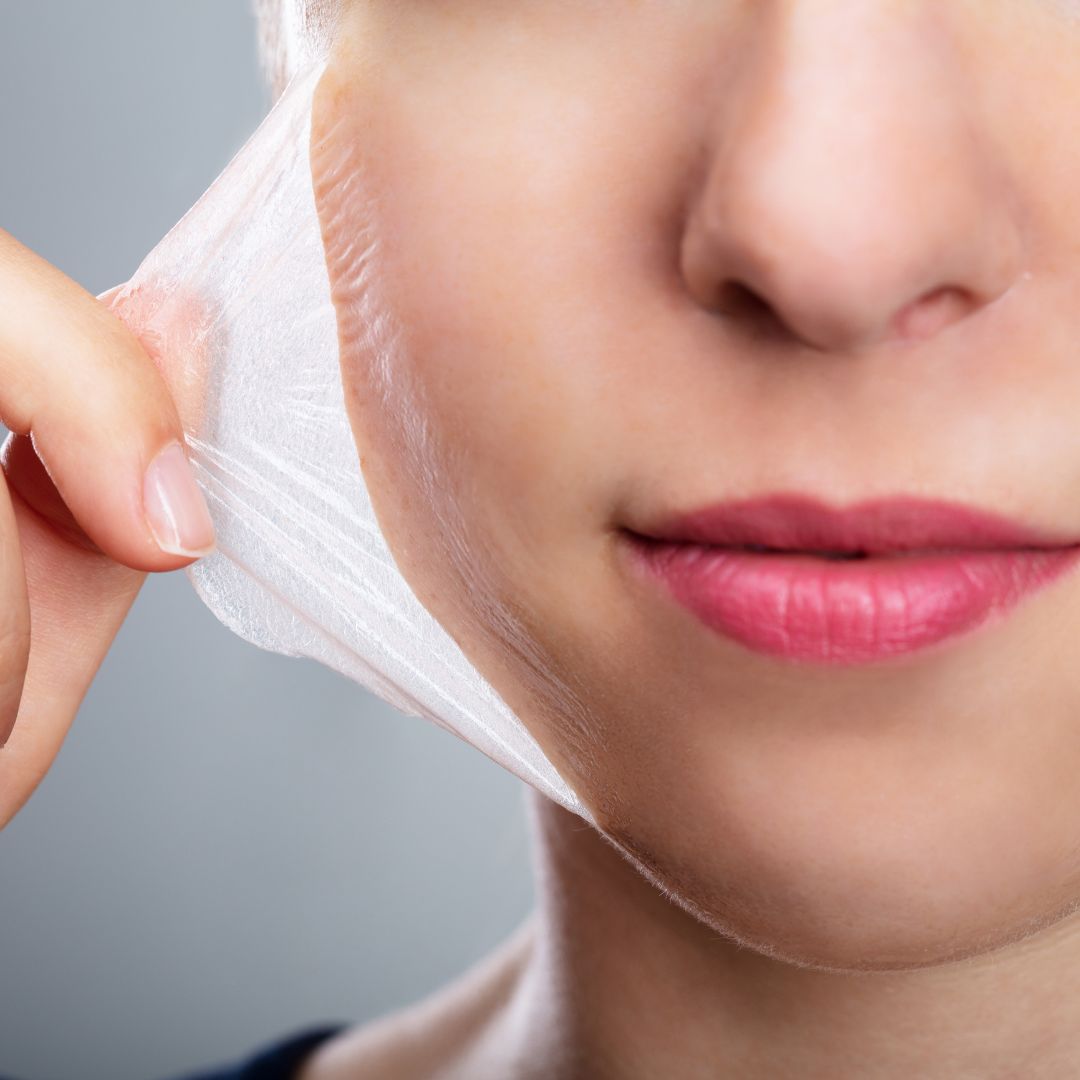 Saiba mais sobre o Peeling Cróton: Seu Aliado para uma Pele Deslumbrante